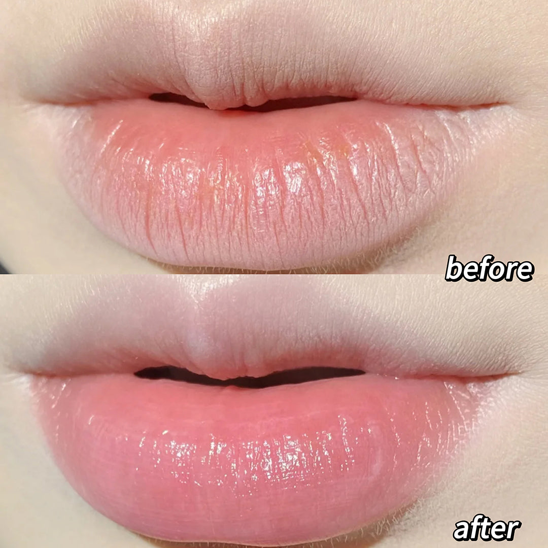Before and after comparison of lips with 'before' on top and 'after' on bottom.